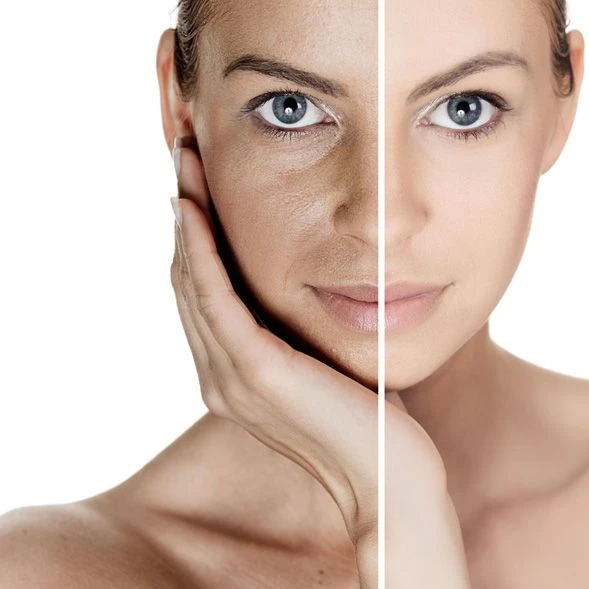 Corregir manchas faciales con Micropigmentación